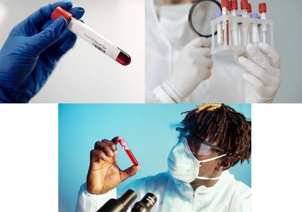 application of edta blood collection tube 4ml